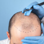 Strategies Rere Manage Financial Forecast